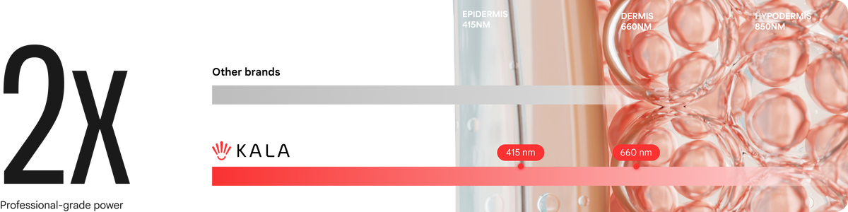 Comparison chart