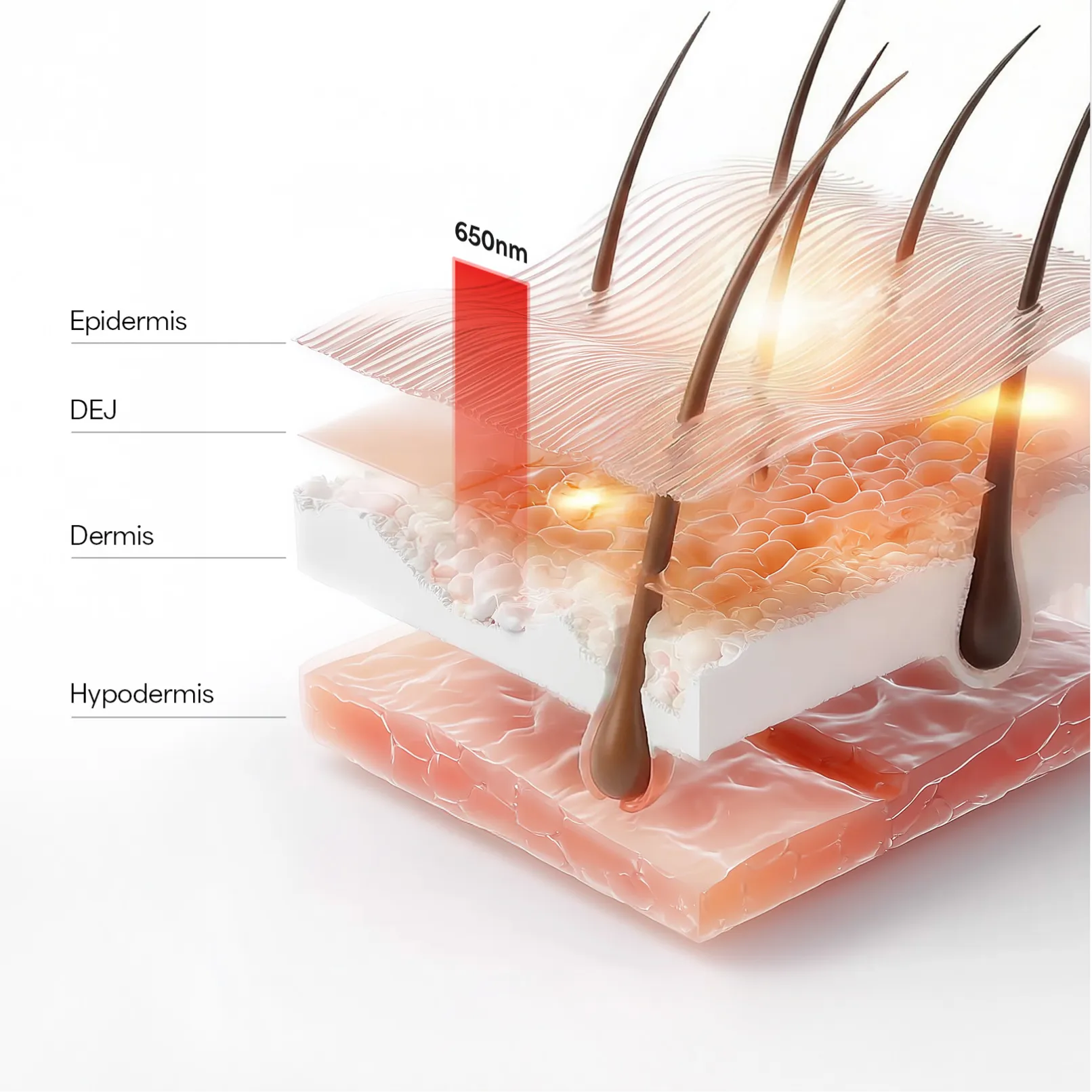 Kala Red Light Cross-sectional diagram of skin layers with hair and melanin labeled